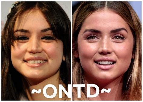 Ana de Armas Before and After Plastic Surgery: Nose, Boob